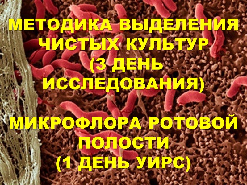 МЕТОДИКА ВЫДЕЛЕНИЯ ЧИСТЫХ КУЛЬТУР  (3 ДЕНЬ ИССЛЕДОВАНИЯ)  МИКРОФЛОРА РОТОВОЙ ПОЛОСТИ  (1